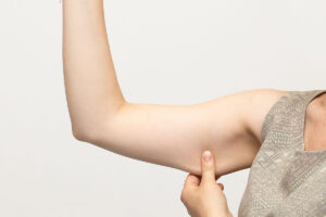 Comment maigrir des bras rapidement ? Votre guide complet