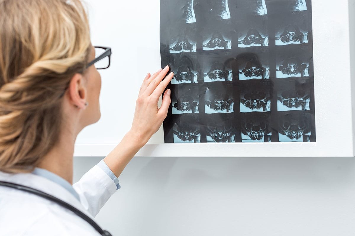 Brûleurs de Graisse et Santé des Os : une Relation à Explorer